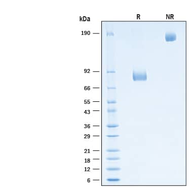 2 μg/lane of Biotinylated Recombinant Human IL-1Rrp2/IL-1R6 Fc Chimera Avi-tag Protein (Catalog # AVI11116) was resolved with SDS-PAGE under reducing (R) and non-reducing (NR) conditions and visualized by Coomassie® Blue staining, showing bands at 78-87 kDa and 156-174 kDa, respectively.