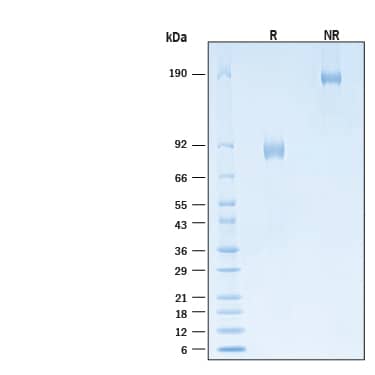 2 μg/lane of Biotinylated Recombinant Human IL-3R alpha/CD123 Fc Chimera Avi-tag Protein (Catalog # AVI11140) was resolved with SDS-PAGE under reducing (R) and non-reducing (NR) conditions and visualized by Coomassie® Blue staining, showing bands at 83-93 kDa and 170-190 kDa, respectively.