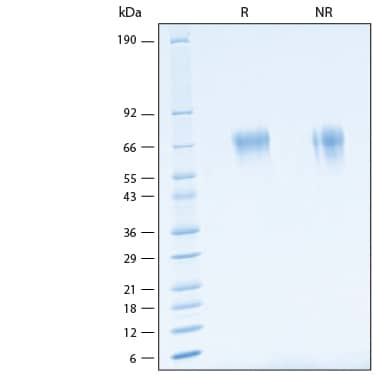 2 μg/lane of Recombinant Human IL-18 R alpha/IL-1 R5 Avi-tag His-tag Protein (Catalog # AVI11179) was resolved with SDS-PAGE under reducing (R) and non-reducing (NR) conditions and visualized by Coomassie® Blue staining, showing bands at 63-71 kDa.