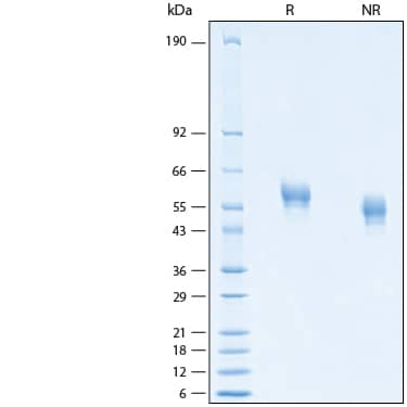 2 μg/lane of Recombinant Human IL-18 R beta/IL-1 R7 His-tag Avi-tag Protein (Catalog # AVI11210) was resolved with SDS-PAGE under reducing (R) and non-reducing (NR) conditions and visualized by Coomassie® Blue staining, showing bands at 48-61 kDa.