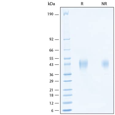 2 μg/lane of Recombinant Human IL-18 BPa His-tag Avi-tag Protein (Catalog # AVI11236) was resolved with SDS-PAGE under reducing (R) and non-reducing (NR) conditions and visualized by Coomassie® Blue staining, showing bands at 40-46 kDa.