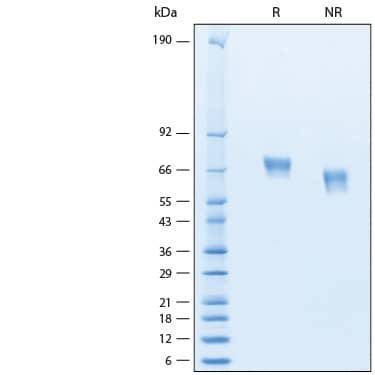 2 μg/lane of Recombinant Human MAdCAM-1 His-tag Avi-tag Protein (Catalog # AVI11276) was resolved with SDS-PAGE under reducing (R) and non-reducing (NR) conditions and visualized by Coomassie® Blue staining, showing bands at 65-75 kDa.