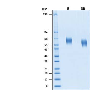 2 μg/lane of Biotinylated Recombinant Human IL‑1 RI Avi-tag His-tag Protein (Catalog # AVI11319) was resolved with SDS-PAGE under reducing (R) and non-reducing (NR) conditions and visualized by Coomassie® Blue staining, showing bands at 55-66 kDa.