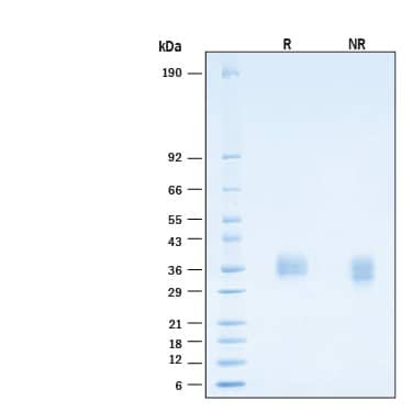 2 μg/lane of Biotinylated Recombinant Human Fc gamma  RIIA/CD32a Avi-tag His-tag Protein (Catalog # AVI1330) was resolved with SDS-PAGE under reducing (R) and non-reducing (NR) conditions and visualized by Coomassie® Blue staining, showing bands at 32-39 kDa.