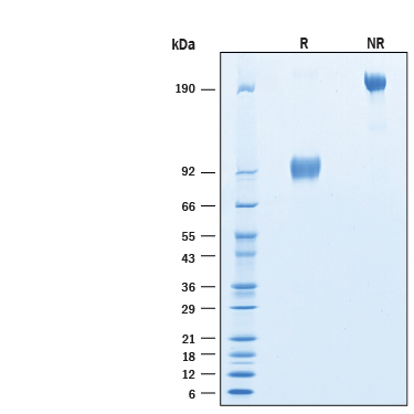 2 μg/lane of Biotinylated Recombinant Human IL-17RA/IL-17R Fc Chimera Avi-tag Protein (Catalog # AVI177) was resolved with SDS-PAGE under reducing (R) and non-reducing (NR) conditions and visualized by Coomassie® Blue staining, showing bands at 90-100 kDa and 180-200 kDa, respectively.