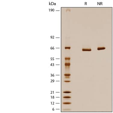 1 μg/lane of Recombinant Human 5'-Nucleotidase/CD73 His-tag Avi-tag Protein (Catalog # AVI5795) was resolved with SDS-PAGE under reducing (R) and non-reducing (NR) conditions and visualized by silver staining, showing bands at 60-66 kDa.