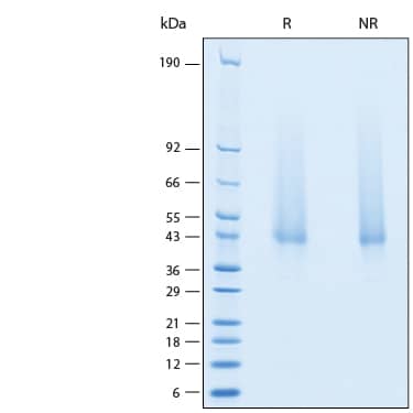 2 μg/lane of Recombinant Human PILR-alpha Avi-tag His-tag Protein (Catalog # AVI6484) was resolved with SDS-PAGE under reducing (R) and non-reducing (NR) conditions and visualized by Coomassie® Blue staining, showing bands at 39-47 kDa.