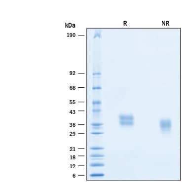 2 μg/lane of Biotinylated Recombinant Human 4-1BB/TNFRSF9 His Avi-tag Protein (Catalog # AVI9220) was resolved with SDS-PAGE under reducing (R) and non-reducing (NR) conditions and visualized by Coomassie® Blue staining, showing bands at 34-41 kDa.