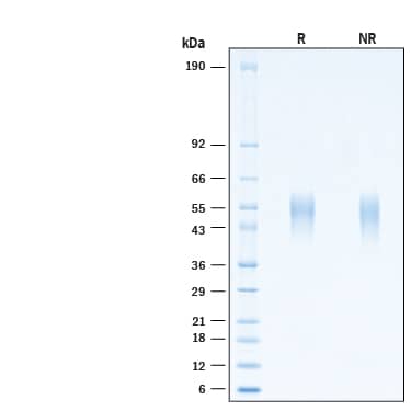 2 μg/lane of Biotinylated Recombinant Human IL-21R His-tag Avi-tag Protein (Catalog # AVI9249) was resolved with SDS-PAGE under reducing (R) and non-reducing (NR) conditions and visualized by Coomassie® Blue staining, showing bands at 51-59 kDa.