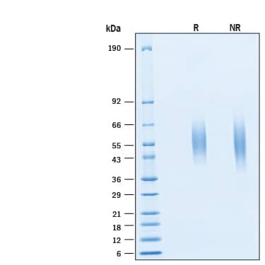 2 μg/lane of Biotinylated Recombinant Human B7‑H6 His-tag Avi-tag Protein (Catalog # AVI9309) was resolved with SDS-PAGE under reducing (R) and non-reducing (NR) conditions and visualized by Coomassie® Blue staining, showing bands at 50-58 kDa.