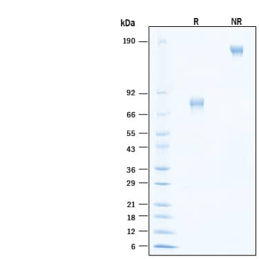 2 μg/lane of Biotinylated Recombinant Human IL-21R Fc Chimera Avi-tag Protein (Catalog # AVI991) was resolved with SDS-PAGE under reducing (R) and non-reducing (NR) conditions and visualized by Coomassie® Blue staining, showing bands at 69-84 kDa and 140-170 kDa, respectively.