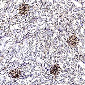  alpha 2u‑Globulin was detected in immersion fixed paraffin-embedded sections of rat kidney using Mouse Anti-Rat  alpha 2u‑Globulin Biotinylated Monoclonal Antibody (Catalog # BAM586) at 15 &micro;g/mL for 1 hour at room temperature followed by incubation with the Anti-Mouse IgG VisUCyte&trade; HRP Polymer Antibody (VC001). Before incubation with the primary antibody, tissue was subjected to heat-induced epitope retrieval using Antigen Retrieval Reagent-Basic (CTS013). Tissue was stained using DAB (brown) and counterstained with hematoxylin (blue). Specific staining was localized to glomeruli. Staining was performed using our protocol for IHC Staining with VisUCyte HRP Polymer Detection Reagents.