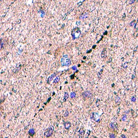 Orexin A/Hypocretin‑1 was detected in immersion fixed paraffin-embedded sections of Human Hypothalamus using Mouse Anti-Human/Mouse Orexin A/Hypocretin‑1 Biotinylated Monoclonal Antibody (Catalog # BAM763) at 10 µg/mL for 1 hour at room temperature followed by incubation with the Anti-Mouse IgG VisUCyte™ HRP Polymer Antibody (Catalog # VC001). Before incubation with the primary antibody, tissue was subjected to heat-induced epitope retrieval using VisUCyte Antigen Retrieval Reagent-Basic (Catalog # VCTS021). Tissue was stained using DAB (brown) and counterstained with hematoxylin (blue). Specific staining was localized to synaptic boutons. View our protocol for IHC Staining with VisUCyte HRP Polymer Detection Reagents.