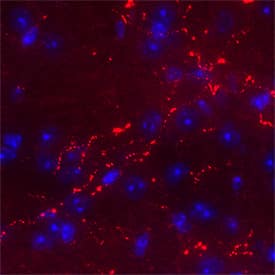 Orexin A/Hypocretin‑1 was detected in perfusion fixed frozen sections of Mouse Hypothalamus using Mouse Anti-Human/Mouse Orexin A/Hypocretin‑1 Biotinylated Monoclonal Antibody (Catalog # BAM763) at 5 µg/mL overnight at 4 °C. Tissue was stained using the NorthernLights™ 557-conjugated Streptavidin (red; Catalog # NL999) and counterstained with DAPI (blue). Specific staining was localized to synaptic boutons. View our protocol for IHC Staining with VisUCyte HRP Polymer Detection Reagents.