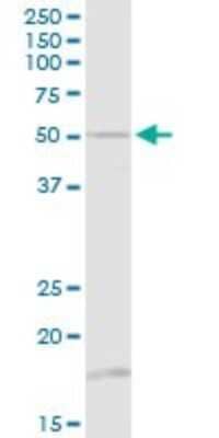 beta I Tubulin Antibody (H00081027-D01P): Novus Biologicals