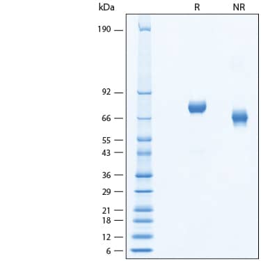 2 μg/lane of Recombinant Human IL-12 Biotinylated Protein (Catalog # BT10018) was resolved with SDS-PAGE under reducing (R) and non-reducing (NR) conditions and visualized by Coomassie® Blue staining, showing bands at 68-80 kDa.