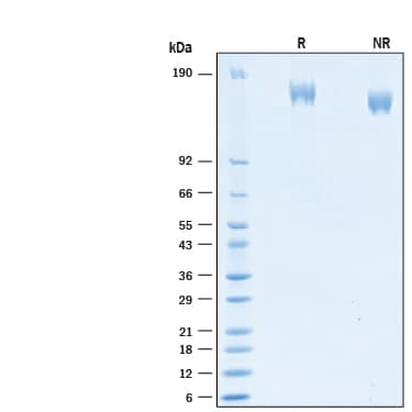 2 μg/lane of Biotinylated Recombinant SARS-CoV-2 B.1.1.7 S (GCN4-IZ) His-tag Protein (Catalog # BT10796) was resolved with SDS-PAGE under reducing (R) and non-reducing (NR) conditions and visualized by Coomassie® Blue staining, showing bands at 150-175 kDa.