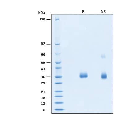 2 μg/lane of Biotinylated Recombinant SARS-CoV-2 B.1.1.529 Spike RBD His-tag Protein (Catalog # BT11056) was resolved with SDS-PAGE under reducing (R) and non-reducing (NR) conditions and visualized by Coomassie® Blue staining, showing bands at 33-39 kDa.