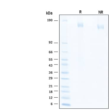 2 μg/lane of Biotinylated Recombinant SARS-CoV-2 B.1.1.529 Spike Protein (Catalog # BT11060) was resolved with SDS-PAGE under reducing (R) and non-reducing (NR) conditions and visualized by Coomassie® Blue staining, showing bands at 155-174 kDa.