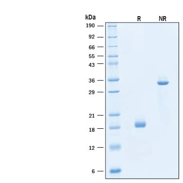 2 μg/lane of Biotinylated Recombinant Human M‑CSF Protein (Catalog # BT216) was resolved with SDS-PAGE under reducing (R) and non-reducing (NR) conditions and visualized by Coomassie® Blue staining, showing bands at 15-22 kDa and 30-40 kDa, respectively.