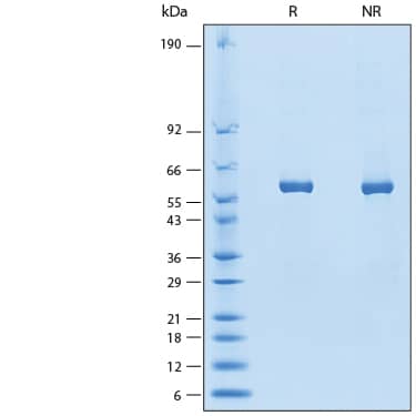 2 μg/lane of Recombinant Human IL-27 His-tag Biotinylated Protein (Catalog # BT2526) was resolved with SDS-PAGE under reducing (R) and non-reducing (NR) conditions and visualized by Coomassie® Blue staining, showing bands at 55-64 kDa.