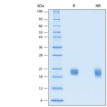 2 μg/lane of Recombinant Human IL-33 Biotinylated Protein (Catalog # BT3625) was resolved with SDS-PAGE under reducing (R) and non-reducing (NR) conditions and visualized by Coomassie® Blue staining, showing bands at 18-22 kDa.
