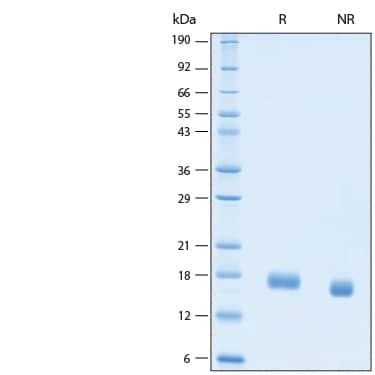 2 μg/lane of Recombinant Human IL-21 Biotinylated Protein (Catalog # BT8879) was resolved with SDS-PAGE under reducing (R) and non-reducing (NR) conditions and visualized by Coomassie® Blue staining, showing bands at 15-20 kDa.