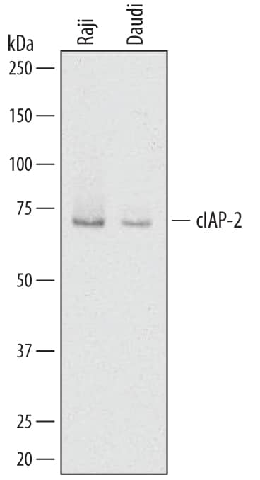 Western blot shows lysates of Raji human Burkitt's lymphoma cell line and Daudi human Burkitt's lymphoma cell line. PVDF membrane was probed with 1 µg/mL of Goat Anti-Human cIAP-2/HIAP-1 Biotinylated Antigen Affinity-purified Polyclonal Antibody (Catalog # BAF8171) followed by Streptavidin-HRP (Catalog # DY998). A specific band was detected for cIAP-2/HIAP-1 at approximately 68 kDa (as indicated). This experiment was conducted under reducing conditions and using Immunoblot Buffer Group 1.