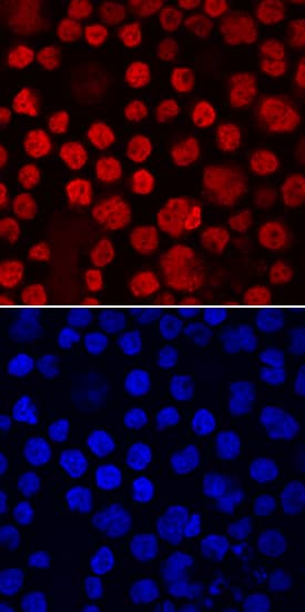 c-Maf was detected in immersion fixed RPMI 8226 human multiple myeloma cell line using Mouse Anti-Human c-Maf Monoclonal Antibody (Catalog # MAB8227) at 10 µg/mL for 3 hours at room temperature. Cells were stained using the NorthernLights™ 557-conjugated Anti-Mouse IgG Secondary Antibody (red, upper panel; Catalog # NL007) and counterstained with DAPI (blue, lower panel). Specific staining was localized to nuclei. View our protocol for Fluorescent ICC Staining of Non-adherent Cells.