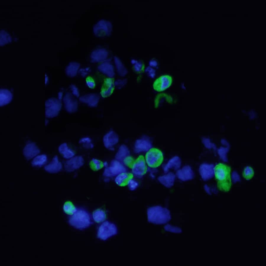 c-Myc was detected in immersion fixed HEK293 human embryonic kidney cell line transfected with c-Myc-tagged Serotonin Receptor using Mouse Anti-Human c‑Myc Alexa Fluor® 488‑conjugated Monoclonal Antibody (green, Catalog # IC3696G) and counterstained with DAPI (blue). View our protocol for Fluorescent ICC Staining of Non-adherent Cells.
