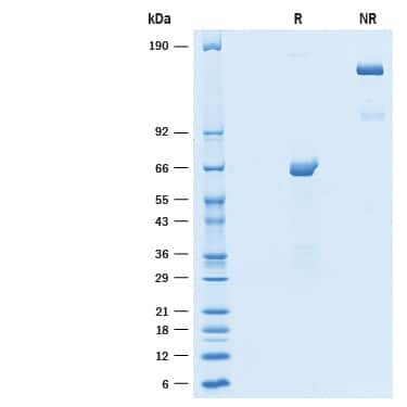 2 μg/lane of Recombinant Human epsilon-Sarcoglycan Fc Chimera (Catalog # 10170-SG) was resolved with SDS-PAGE under reducing (R) and non-reducing (NR) conditions and visualized by Coomassie® blue staining, showing bands at 57-71 kDa and 110-140 kDa, respectively. 