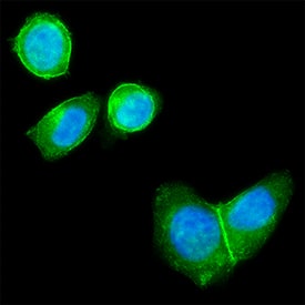 ErbB2/Her2 was detected in immersion fixed SK‑BR‑3 human breast cancer cell line using Human Anti-Human ErbB2/Her2 (Research Grade Trastuzumab Biosimilar) Alexa Fluor® 488‑conjugated Monoclonal Antibody (Catalog # FAB9589G, green) at 5 µg/mL for 3 hours at room temperature. Cells were counterstained with DAPI (blue). Specific staining was localized to cell membrane and cytoplasm. Staining was performed using our protocol for Fluorescent ICC Staining of Non-adherent Cells.