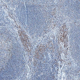 IL-23R was detected in immersion fixed paraffin-embedded sections of human lymph node using Mouse Anti-Cynomolgus Monkey IL-23R Monoclonal Antibody (Catalog # MAB106243) at 15 µg/mL for 1 hour at room temperature followed by incubation with the Anti-Mouse IgG VisUCyte™ HRP Polymer Antibody (VC001). Before incubation with the primary antibody, tissue was subjected to heat-induced epitope retrieval using Antigen Retrieval Reagent-Basic (CTS013). Tissue was stained using DAB (brown) and counterstained with hematoxylin (blue). Specific staining was localized to cell surface and cytoplasm in lymphocytes. Staining was performed using our protocol for IHC Staining with VisUCyte HRP Polymer Detection Reagents.
