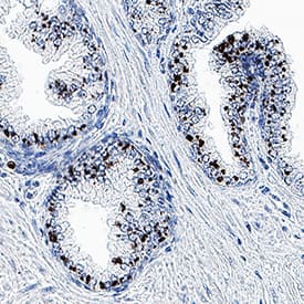 PSGR was detected in immersion fixed paraffin-embedded sections of human normal prostate using Mouse Anti-Human PSGR Monoclonal Antibody (Catalog # MAB10669) at 5 µg/mL for 1 hour at room temperature followed by incubation with the Anti-Mouse IgG VisUCyte™ HRP Polymer Antibody (VC001). Before incubation with the primary antibody, tissue was subjected to heat-induced epitope retrieval using Antigen Retrieval Reagent-Basic (CTS013). Tissue was stained using DAB (brown) and counterstained with hematoxylin (blue). Specific staining was localized to cytoplasm in glandular epithelial cells. Staining was performed using our protocol for IHC Staining with VisUCyte HRP Polymer Detection Reagents.