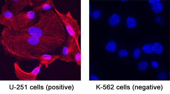 NF‑L was detected in immersion fixed U251 human myeloma cell line (positive) and K562 human chronic myelogenous leukemia cell line (negative) using Mouse Anti-Human NF‑L Monoclonal Antibody (Catalog # MAB10680) at 8 µg/mL for 3 hours at room temperature. Cells were stained using the NorthernLights™ 557-conjugated Anti-Mouse IgG Secondary Antibody (red; Catalog # NL007) and counterstained with DAPI (blue). Specific staining was localized to cytoplasm.