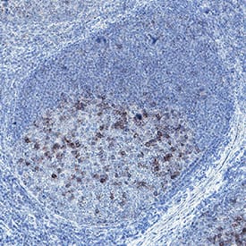 PD‑1 was detected in immersion fixed paraffin-embedded sections of human tonsil using Rabbit Anti-Human PD‑1 Monoclonal Antibody (Catalog # MAB108581) at 10 µg/mL for 1 hour at room temperature followed by incubation with the Anti-Rabbit IgG VisUCyte™ HRP Polymer Antibody (VC003). Before incubation with the primary antibody, tissue was subjected to heat-induced epitope retrieval using Antigen Retrieval Reagent-Basic (CTS013). Tissue was stained using DAB (brown) and counterstained with hematoxylin (blue). Specific staining was localized to lymphocytes in germinal centers. Staining was performed using our protocol for IHC Staining with VisUCyte HRP Polymer Detection Reagents.