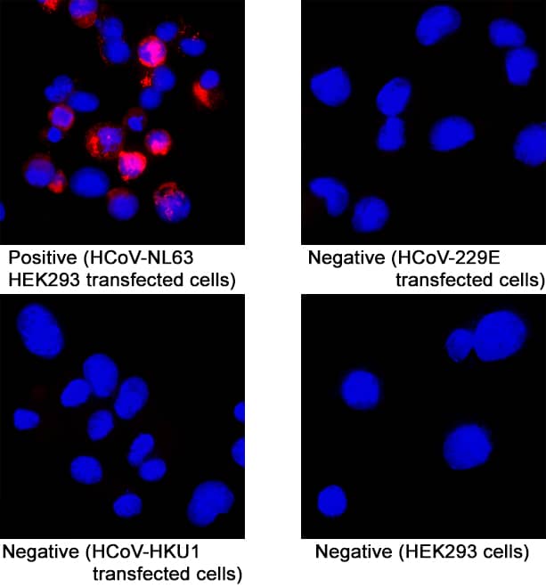 HCoV-NL63 Spike RBD was detected in immersion fixed HEK293 human embryonic kidney cell line transfected (positive staining) and HEK293 human embryonic kidney cell line (non-transfected, or HCoV-229E or HCoV-HKU1 transfected, negative staining) using Mouse Anti-HCoV-NL63 Human Coronavirus Spike RBD Monoclonal Antibody (Catalog # MAB11037) at 8 µg/mL for 3 hours at room temperature. Cells were stained using the NorthernLights™ 557-conjugated Anti-Mouse IgG Secondary Antibody (red; Catalog # NL007) and counterstained with DAPI (blue). Specific staining was localized to cytoplasm. View our protocol for Fluorescent ICC Staining of Cells on Coverslips.