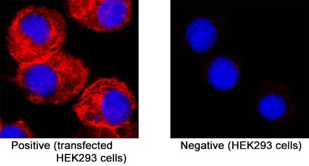 Membrane was detected in immersion fixed HEK293 human embryonic kidney cell line transfected (positive staining) and HEK293 human embryonic kidney cell line (non-transfected, negative staining) using Mouse Anti-SARS-CoV-2 Membrane Monoclonal Antibody (Catalog # MAB11038) at 8 µg/mL for 3 hours at room temperature. Cells were stained using the NorthernLights™ 557-conjugated Anti-Mouse IgG Secondary Antibody (red; Catalog # NL007) and counterstained with DAPI (blue). Specific staining was localized to cytoplasm . View our protocol for Fluorescent ICC Staining of Cells on Coverslips.