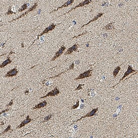 Immunohistochemistry ABCA13 Antibody (2379B) [Unconjugated]