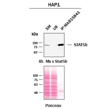 Immunoprecipitation was performed on cell lysate of HAP1 human near-haploid cell line using 2.0 μg of Rabbit Anti-Human Stat5b Monoclonal Antibody (Catalog # MAB15841) pre-coupled to protein G or protein A beads. Immunoprecipitated Stat5b was detected with a Mouse Anti-Stat5b antibody. The Ponceau stained transfers of each blot are shown. SM=10% starting material; UB=10% unbound fraction; IP=immunoprecipitated.  Image, protocol, and testing courtesy of YCharOS Inc. (ycharos.com).