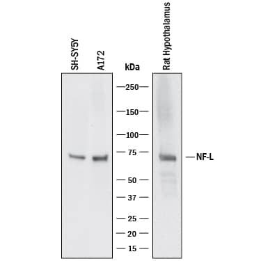 Western blot shows lysates of SH‑SY5Y human neuroblastoma cell line, A172 human glioblastoma cell line and rat hyphothalamus. PVDF membrane was probed with 2 µg/mL of Mouse Anti-Human NF‑L Monoclonal Antibody (Catalog # MAB22164) followed by HRP-conjugated Anti-Mouse IgG Secondary Antibody (HAF018). A specific band was detected for NF‑L at approximately 68 kDa (as indicated). This experiment was conducted under reducing conditions and using Western Blot Buffer Group 1.