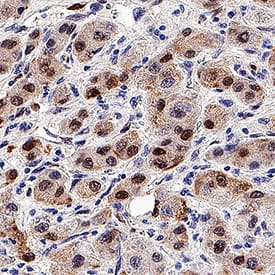 FGF basic/FGF2/bFGF was detected in immersion fixed paraffin-embedded sections of Liver using Rat Anti-Human FGF basic/FGF2/bFGF Monoclonal Antibody (Catalog # MAB2332) at 5 µg/mL for 1 hour at room temperature followed by incubation with the Anti-Rat IgG VisUCyte™ HRP Polymer Antibody (Catalog # VC005). Before incubation with the primary antibody, tissue was subjected to heat-induced epitope retrieval using VisUCyte Antigen Retrieval Reagent-Basic (Catalog # VCTS021). Tissue was stained using DAB (brown) and counterstained with hematoxylin (blue). Specific staining was localized to cell nuclei. View our protocol for IHC Staining with VisUCyte HRP Polymer Detection Reagents.