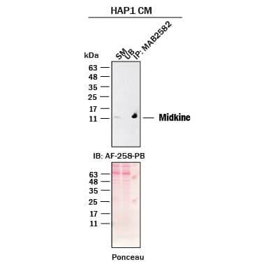 Immunoprecipitation was performed on concentrated culture media from HAP1 human near-haploid cell using 2.0 μg of Mouse Anti-Human Midkine Monoclonal Antibody (Catalog # MAB25823) pre-coupled to protein G or protein A beads.  Immunoprecipitated Midkine was detected with Goat Anti-Human Midkine Polyclonal Antibody (AF-258-PB) at 1.0 μg/ml. The Ponceau stained transfers of each blot are shown. SM=10% starting material; UB=10% unbound fraction; IP=immunoprecipitated.  Image, protocol, and testing courtesy of YCharOS Inc. (ycharos.com).