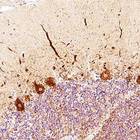 NF‑H was detected in immersion fixed paraffin-embedded sections of human brain cerebellum using Mouse Anti-Human NF‑H Monoclonal Antibody (Catalog # MAB31083) at 3 µg/mL for 1 hour at room temperature followed by incubation with the Anti-Mouse IgG VisUCyte™ HRP Polymer Antibody (Catalog # VC001). Before incubation with the primary antibody, tissue was subjected to heat-induced epitope retrieval using VisUCyte Antigen Retrieval Reagent-Basic (Catalog # VCTS021). Tissue was stained using DAB (brown) and counterstained with hematoxylin (blue). Specific staining was localized to cytoplasm in Purkinjie neurons. View our protocol for IHC Staining with VisUCyte HRP Polymer Detection Reagents.