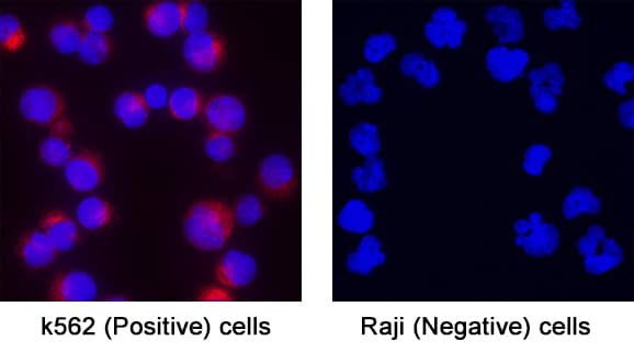 NF‑H was detected in immersion fixed K562 Human Chronic Myelogenous Leukemia Cell Line (Positive) and Raji Human Burkitt's Lymphoma Cell Line (Negative) Cells using Mouse Anti-Human NF‑H Monoclonal Antibody (Catalog # MAB31083) at 8 µg/mL for 3 hours at room temperature. Cells were stained using the NorthernLights™ 557-conjugated Anti-Mouse IgG Secondary Antibody (red; Catalog # NL007) and counterstained with DAPI (blue). Specific staining was localized to cytoplasm. View our protocol for Fluorescent ICC Staining of Non-adherent Cells.