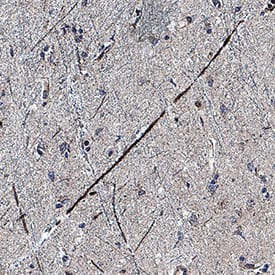 BDNF was detected in immersion fixed paraffin-embedded sections of human brain cortex using Mouse Anti-Human Pro BDNF Monoclonal Antibody (Catalog # MAB31751) at 5 &micro;g/mL for 1 hour at room temperature followed by incubation with the Anti-Mouse IgG VisUCyte&trade; HRP Polymer Antibody (Catalog # VC001). Before incubation with the primary antibody, tissue was subjected to heat-induced epitope retrieval using VisUCyte Antigen Retrieval Reagent-Basic (Catalog # VCTS021). Tissue was stained using DAB (brown) and counterstained with hematoxylin (blue). Specific staining was localized to neuronal processes. View our protocol for IHC Staining with VisUCyte HRP Polymer Detection Reagents.