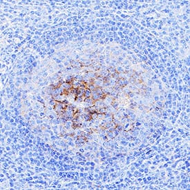 CD14 was detected in immersion fixed paraffin-embedded sections of human tonsil using Mouse Anti-Human CD14 Monoclonal Antibody (Catalog # MAB3832R) at 5 µg/mL for 1 hour at room temperature followed by incubation with the Anti-Mouse IgG VisUCyte™ HRP Polymer Antibody (Catalog # VC001). Before incubation with the primary antibody, tissue was subjected to heat-induced epitope retrieval using VisUCyte Antigen Retrieval Reagent-Basic (Catalog # VCTS021). Tissue was stained using DAB (brown) and counterstained with hematoxylin (blue). Specific staining was localized to cell surface in lymphocytes. View our protocol for IHC Staining with VisUCyte HRP Polymer Detection Reagents.