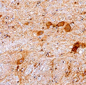 mGluR3 was detected in immersion fixed paraffin-embedded sections of human hypothalamus tissue using Mouse Anti-Human mGluR3 Monoclonal Antibody (Catalog # MAB4668) at 5 µg/mL for 1 hour at room temperature followed by incubation with the Anti-Mouse IgG VisUCyte™ HRP Polymer Antibody (VC001). Before incubation with the primary antibody, tissue was subjected to heat-induced epitope retrieval using Antigen Retrieval Reagent-Basic (CTS013). Tissue was stained using DAB (brown) and counterstained with hematoxylin (blue). Specific staining was localized to cell membrane in neurons. Staining was performed using our IHC Staining with VisUCyte HRP Polymer Detection Reagents protocol.