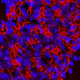 mGluR2 was detected in immersion fixed paraffin-embedded sections of rat brain (cerebellum) using Mouse Anti-Human mGluR2 Monoclonal Antibody (Catalog # MAB46762) at 8 µg/mL for 1 hour at room temperature followed by incubation with the NorthernLights™ 557-conjugated Anti-Mouse IgG Secondary Antibody (NL007). Before incubation with the primary antibody, tissue was subjected to heat-induced epitope retrieval using Antigen Retrieval Reagent-Basic (CTS013). Tissue was stained using DAB (brown) and counterstained with hematoxylin (blue). Specific staining was localized to cell surface of neurons in granular cell layer. Staining was performed using our protocol for Fluorescent IHC Staining of Paraffin-embedded Tissue Sections.