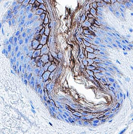 Desmocollin‑1 was detected in immersion fixed paraffin-embedded sections of Human Skin using Rabbit Anti-Human Desmocollin‑1 Monoclonal Antibody (Catalog # MAB4955) at 3 µg/mL for 1 hour at room temperature followed by incubation with the Anti-Rabbit IgG VisUCyte™ HRP Polymer Antibody (Catalog # VC003). Before incubation with the primary antibody, tissue was subjected to heat-induced epitope retrieval using VisUCyte Antigen Retrieval Reagent-Basic (Catalog # VCTS021). Tissue was stained using DAB (brown) and counterstained with hematoxylin (blue). Specific staining was localized to cell membrane in keratinocytes. View our protocol for IHC Staining with VisUCyte HRP Polymer Detection Reagents.